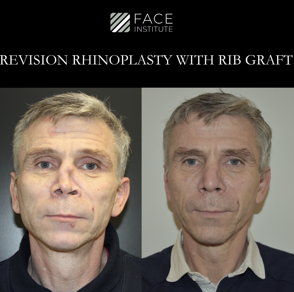 Reconstruction 3