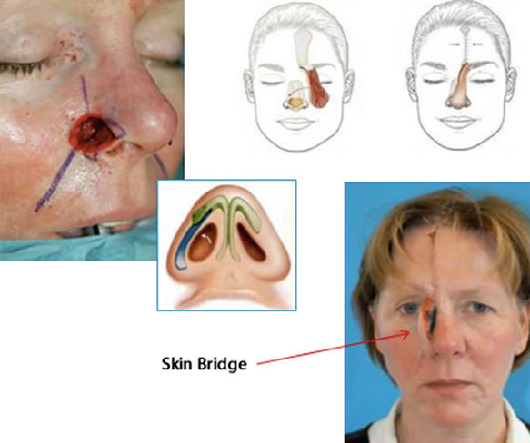 Skin and cartilage structure is missing